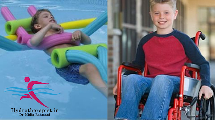 تأثیر آب‌درمانی بر بیماران فلج مغزی (CP)